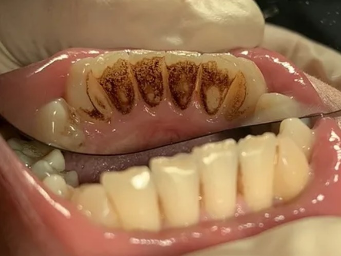 До профессиональной чистки